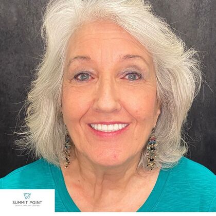 Dr. Sasan Khodabakhsh's patient with dentures and a beautiful smile